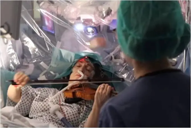Operación Cerebro Violin - Cuánto cuesta operarse el cerebro operacion cerebro violin - Cuánto cuesta operarse el cerebro