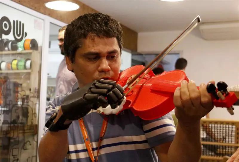 po paraguay protesis violin - Cuánto cuesta una prótesis de pierna en Paraguay