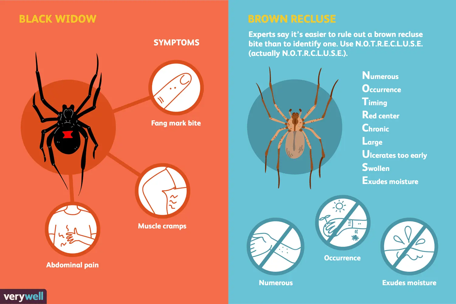 violin spider bite symptoms - How soon after a poisonous spider bite do symptoms occur