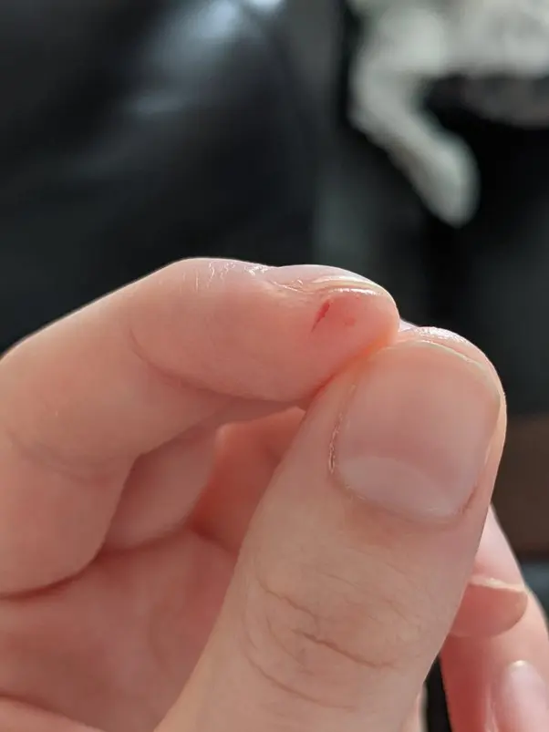 finger hurt violin - What helps sore fingers from violin